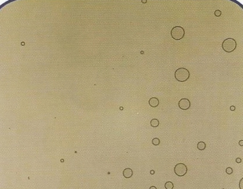 urine