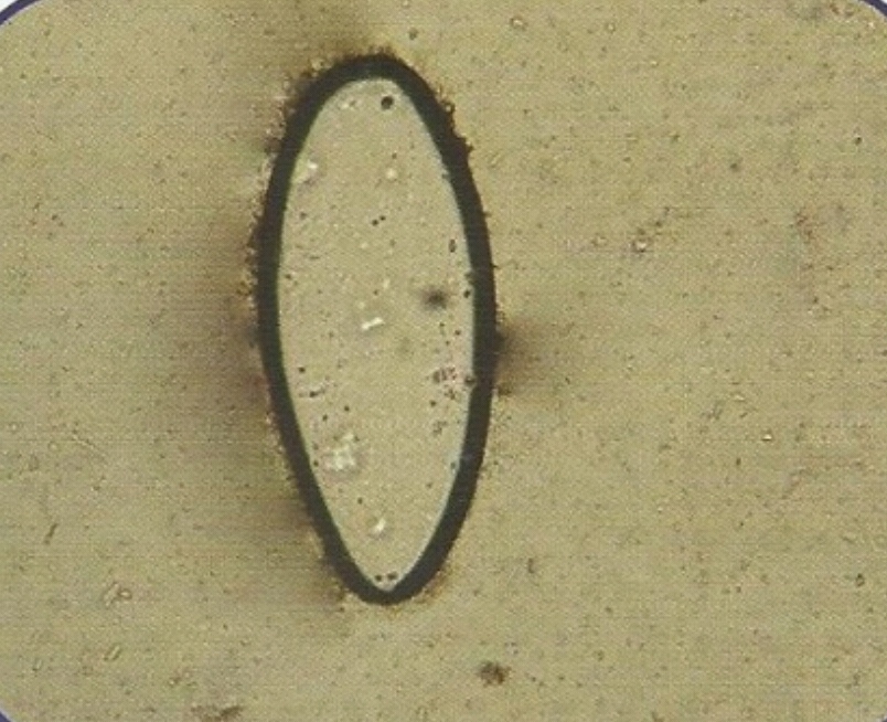 urine