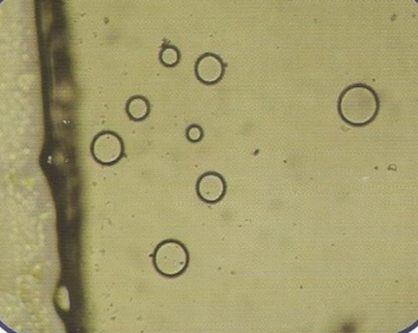 urine