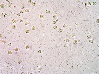 urine