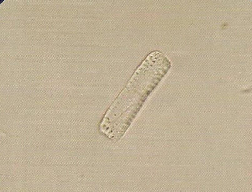 urine