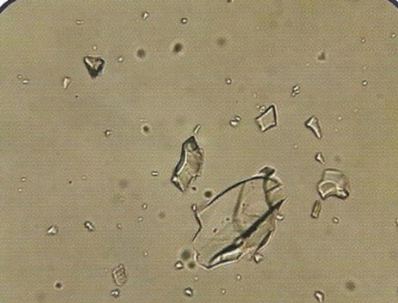 urine