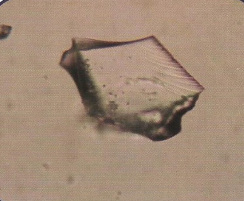 urine