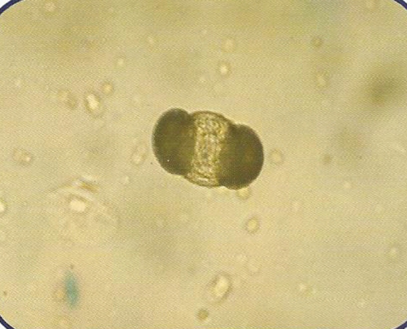 urine