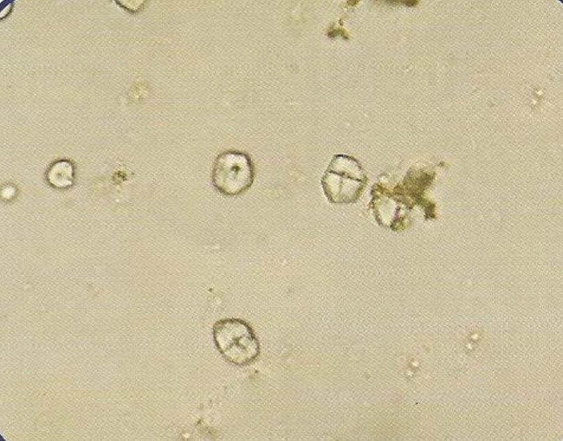 urine
