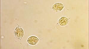 urine