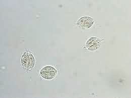 urine