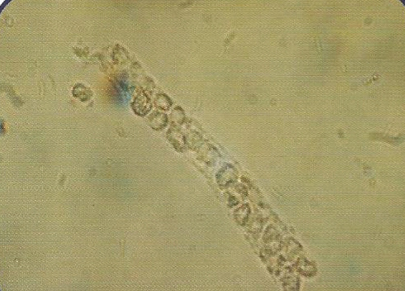 urine