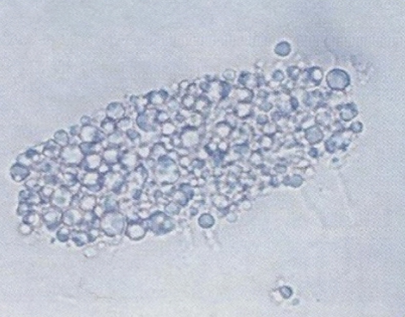 urine