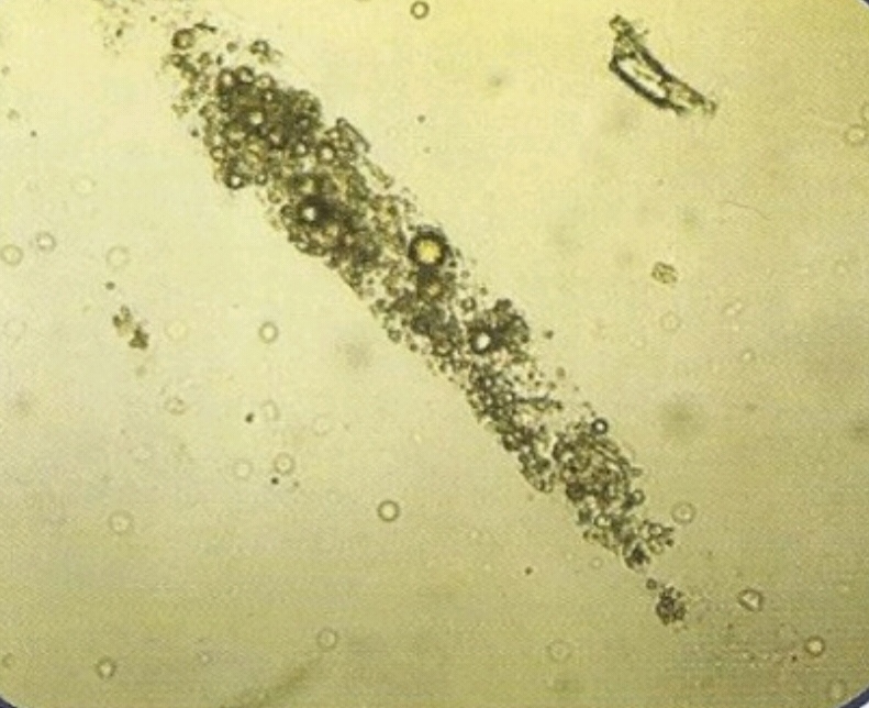 urine