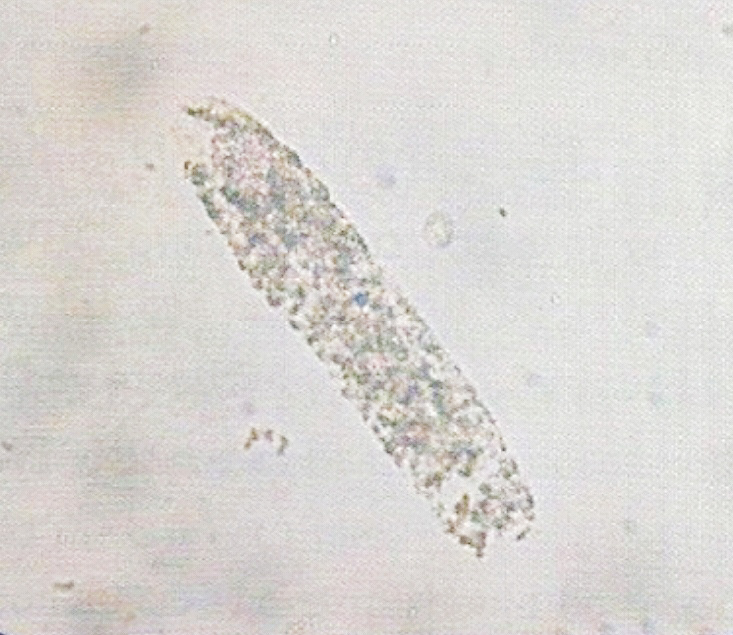 urine