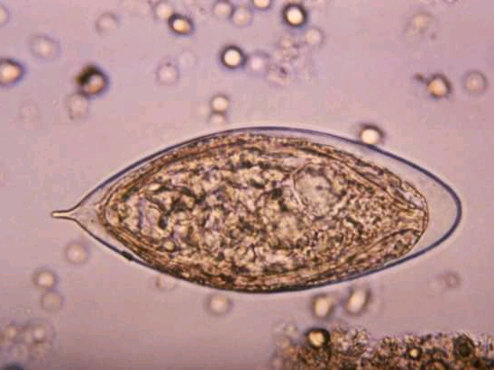 urine
