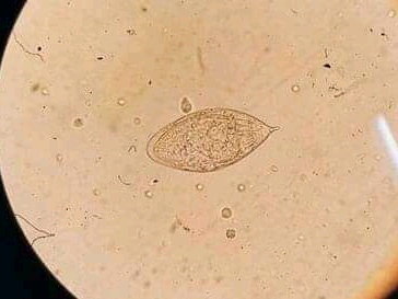 urine