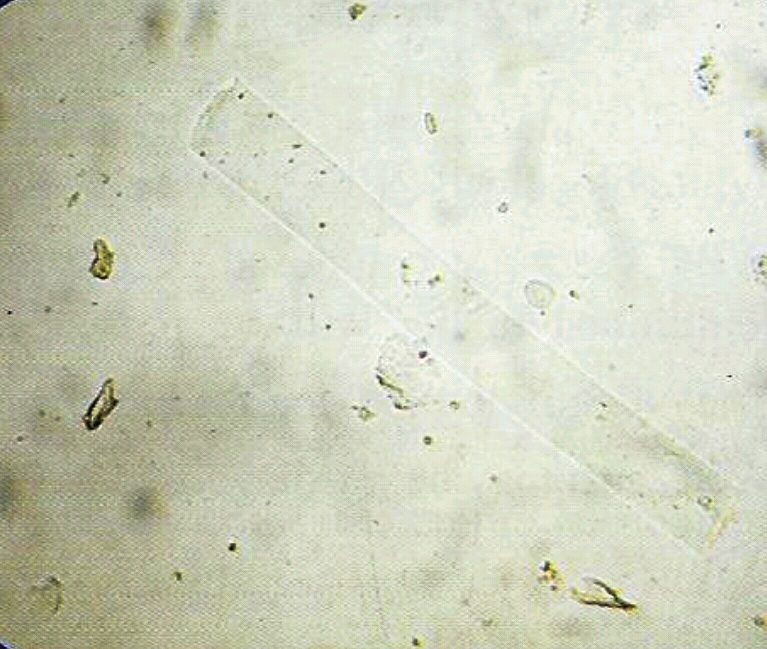 urine
