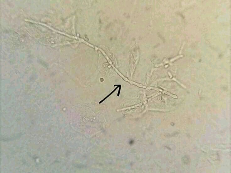 urine