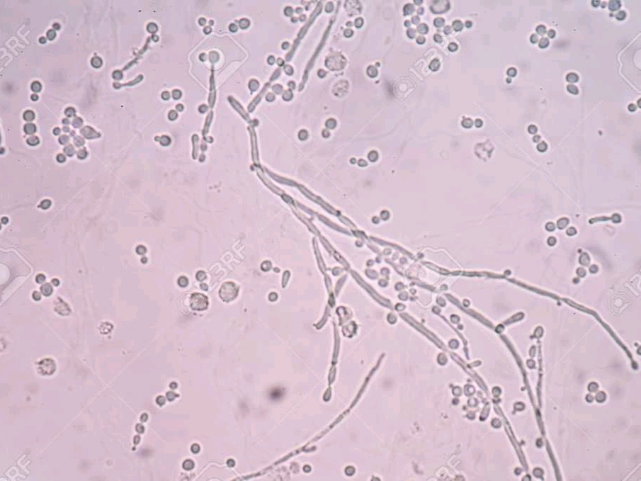 urine