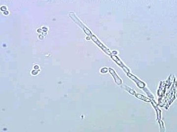urine