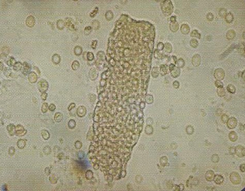 urine