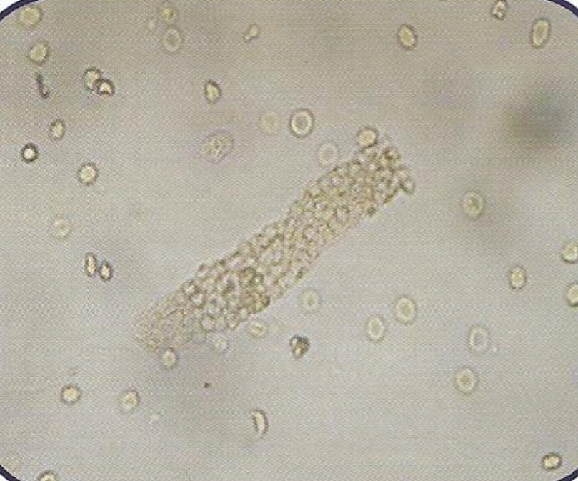 urine