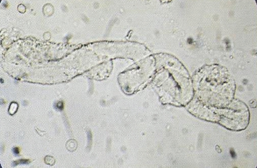 urine