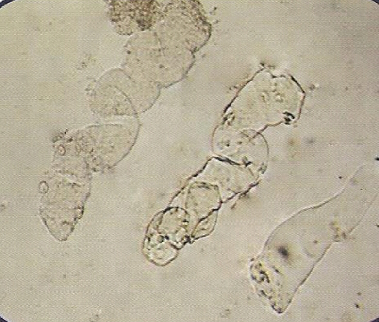 urine