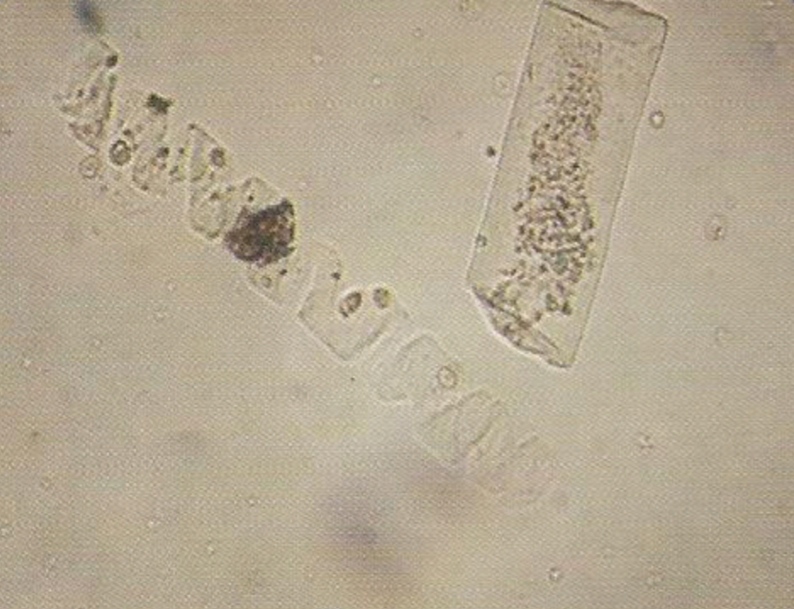 urine