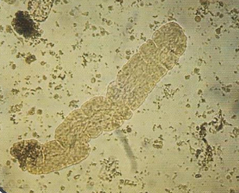 urine