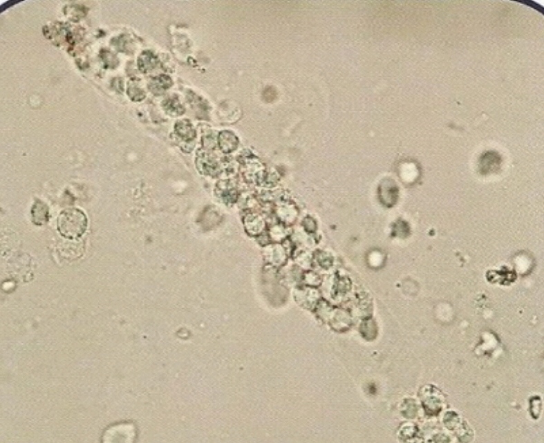 urine