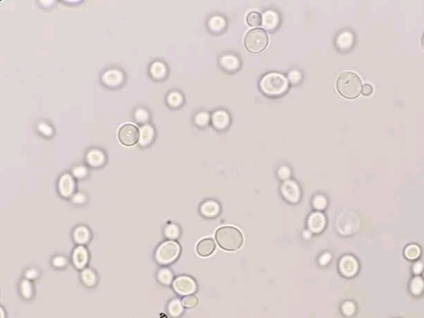 urine