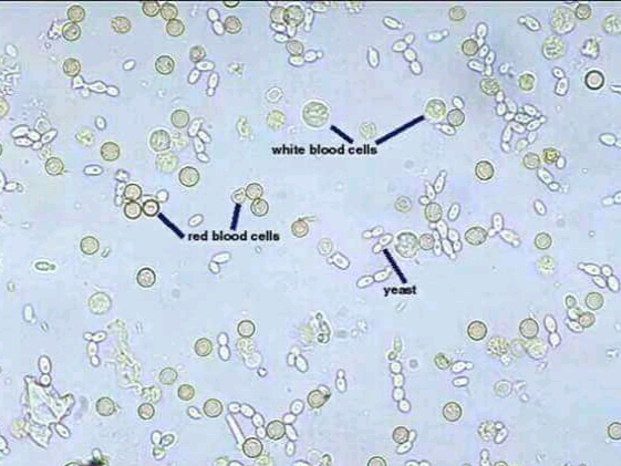 urine
