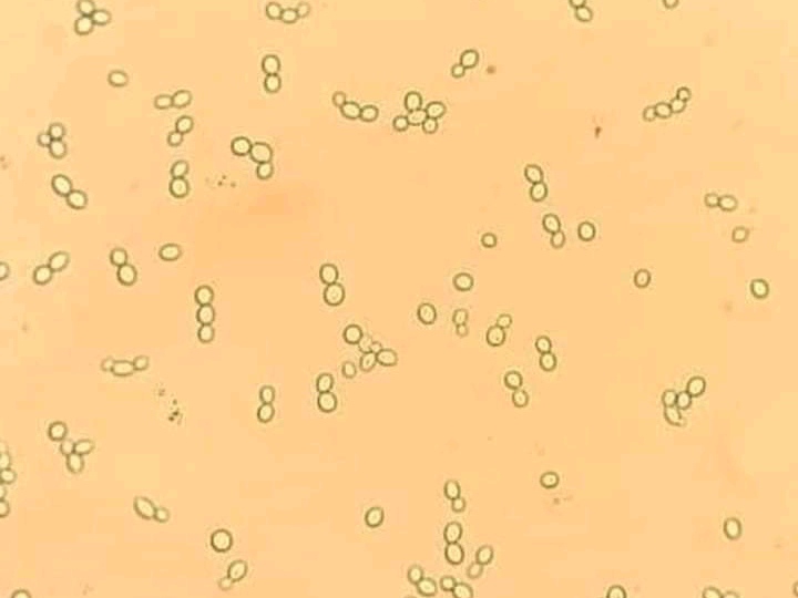 urine