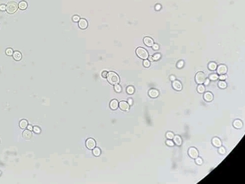 urine