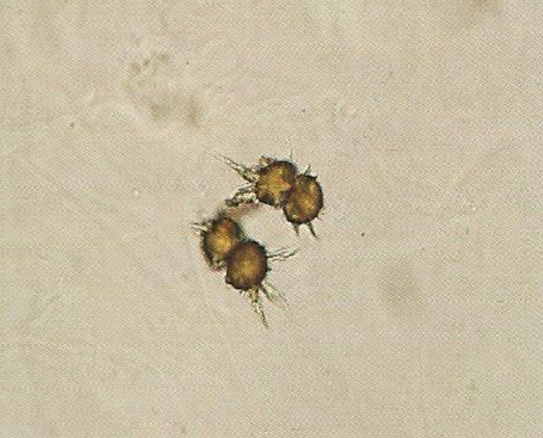 urine