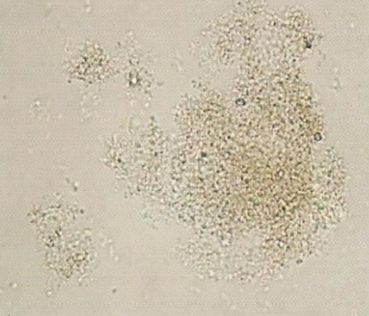 urine
