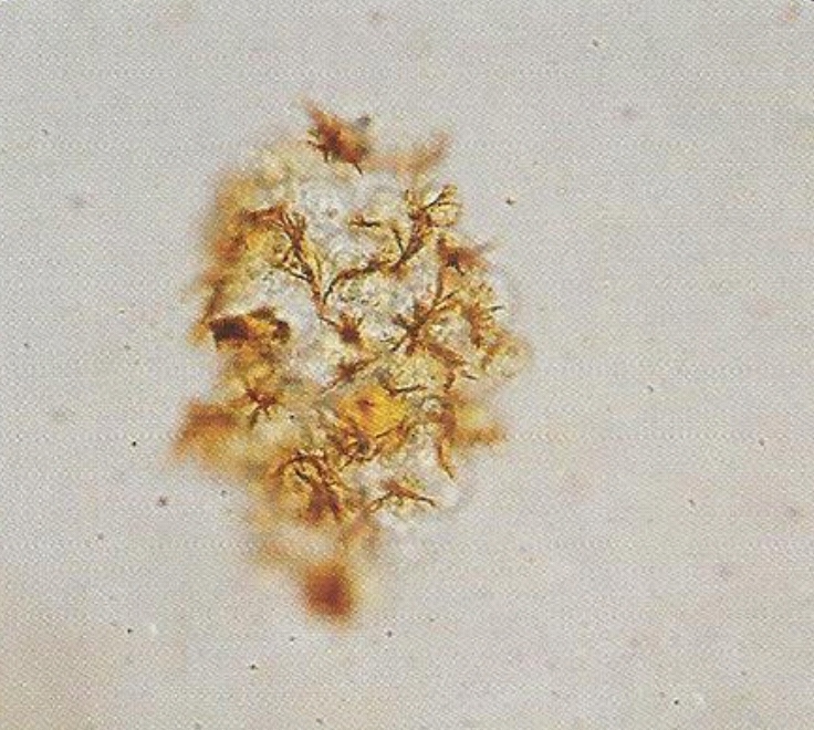 urine