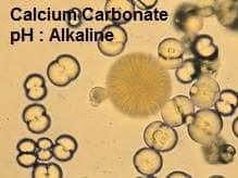 urine