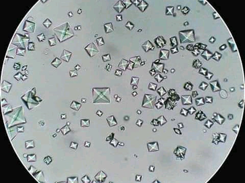 urine