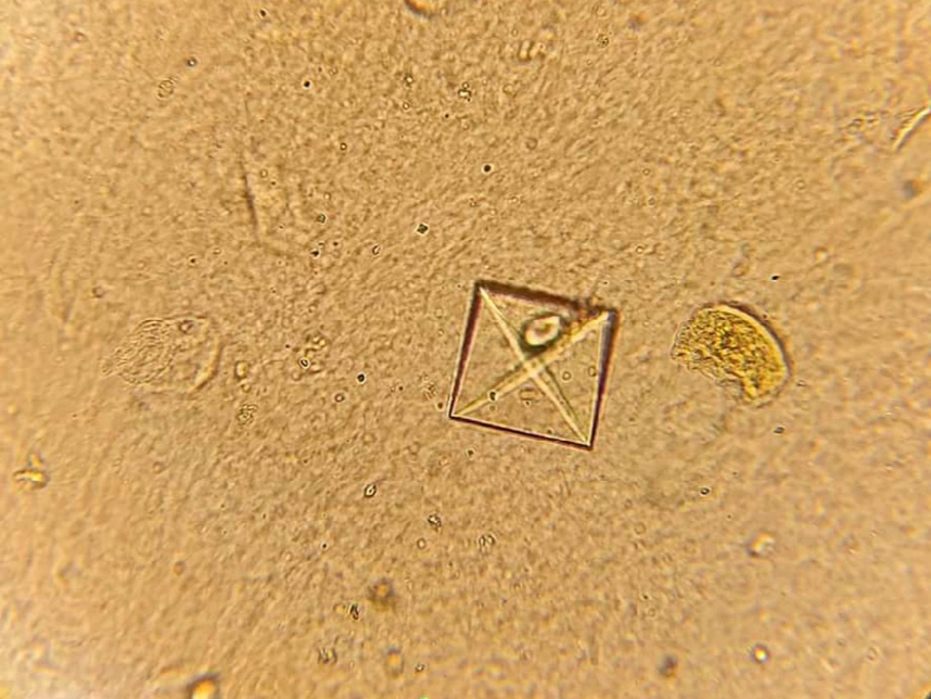 urine