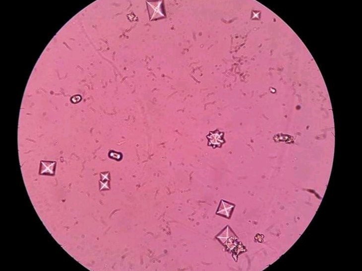 urine