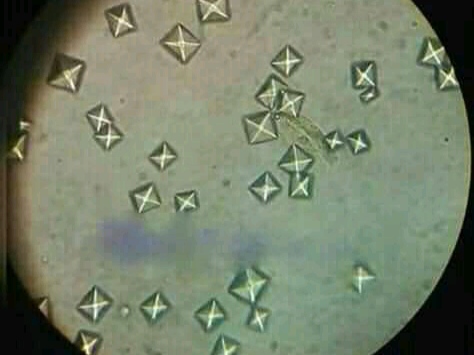 urine