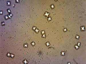 urine