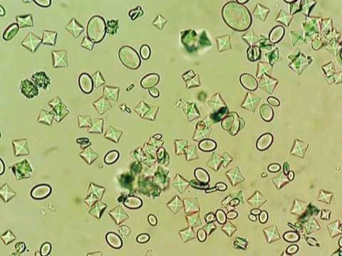 urine