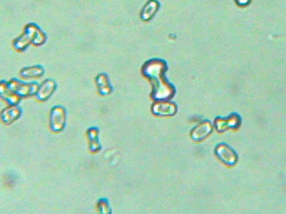 urine