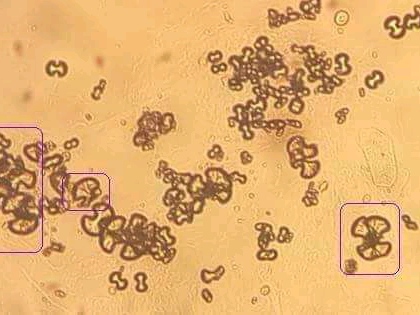 urine
