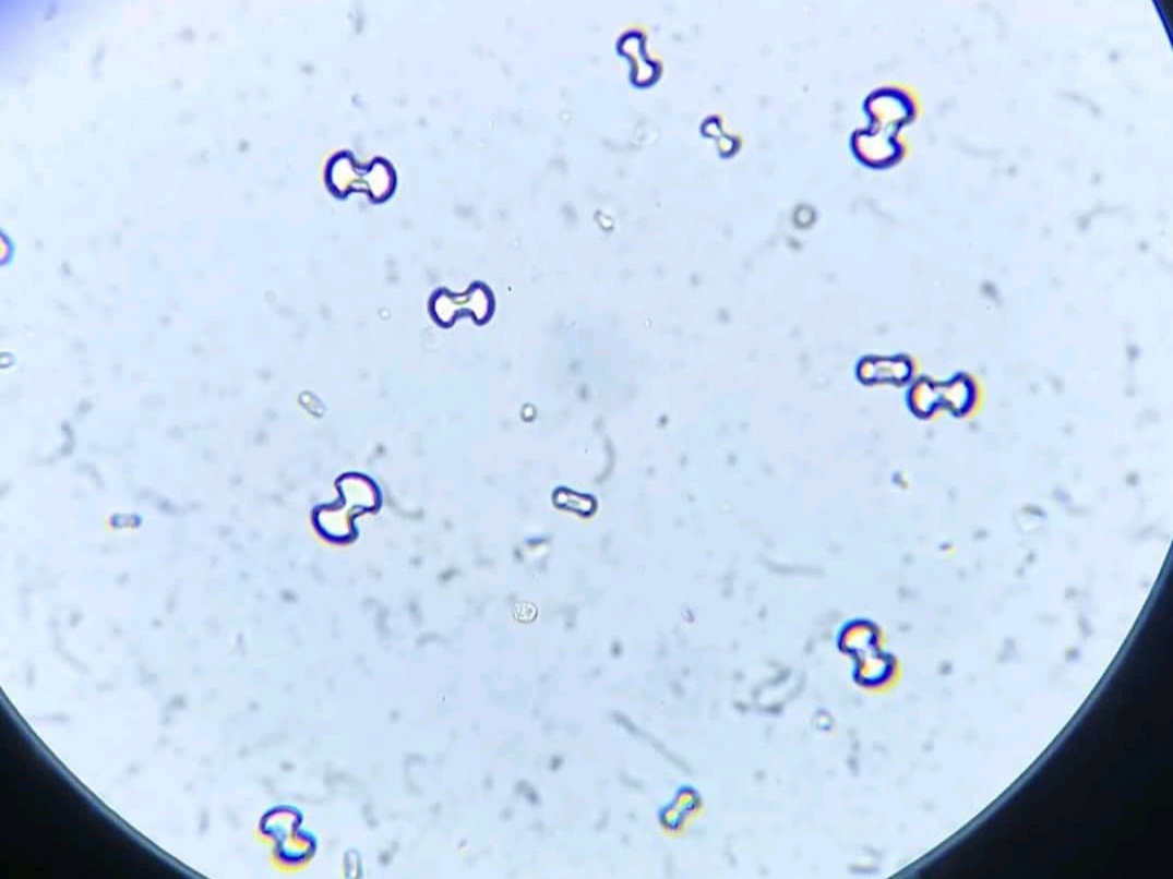 urine