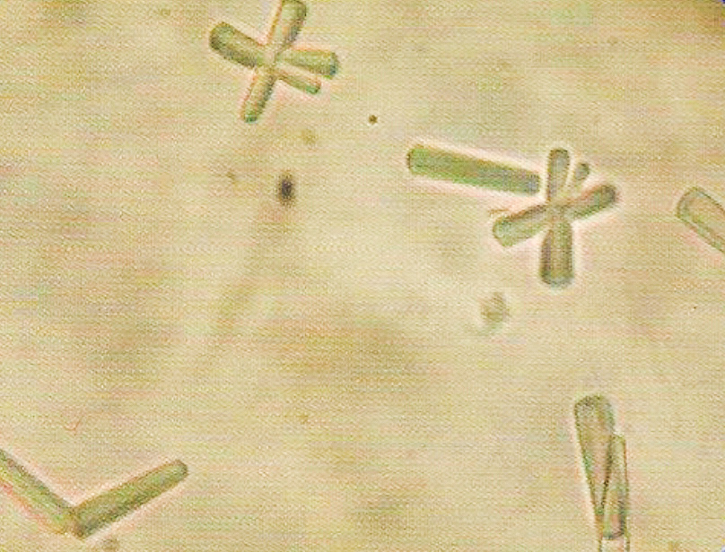 urine