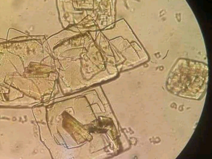 urine