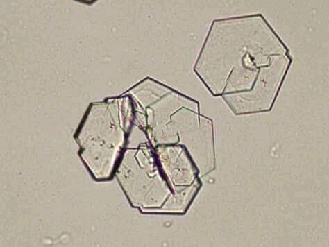 urine