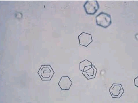 urine