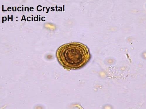 urine